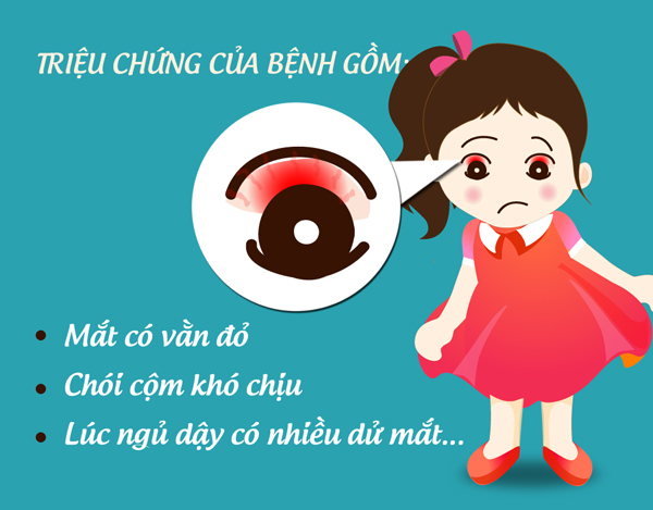 Các cách phòng bệnh đau mắt đỏ